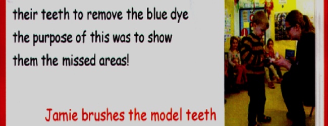 dentist meopham nursery visit