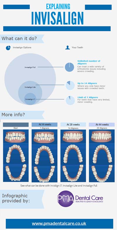 Invisalign Infographic Invisalign Infographic from orthodontist gravesend kent