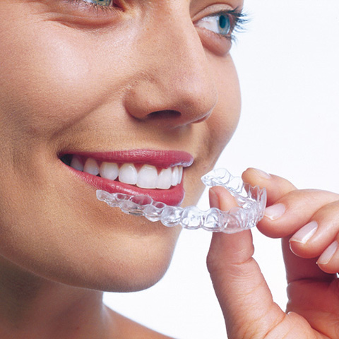 Cleaning Retainers & Invisalign Aligners