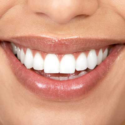 Win Free Teeth Whitening